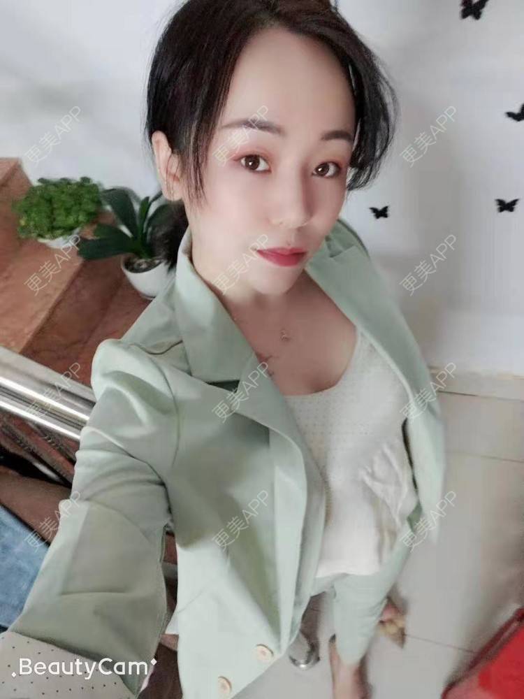 更美 - 生活小甜的腰腹吸脂经验 | 视频日记 | 泉州 | 腰部吸脂