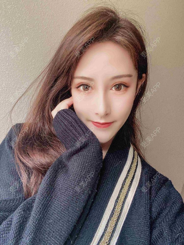 更美 - 鸳鸯戏水、双双溺水的吸脂瘦脸经验 | 吸脂瘦脸 | 南京 | 光纤瘦脸