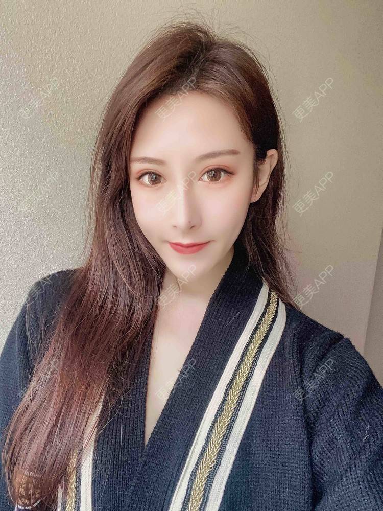 更美 - 鸳鸯戏水、双双溺水的吸脂瘦脸经验 | 吸脂瘦脸 | 南京 | 光纤瘦脸