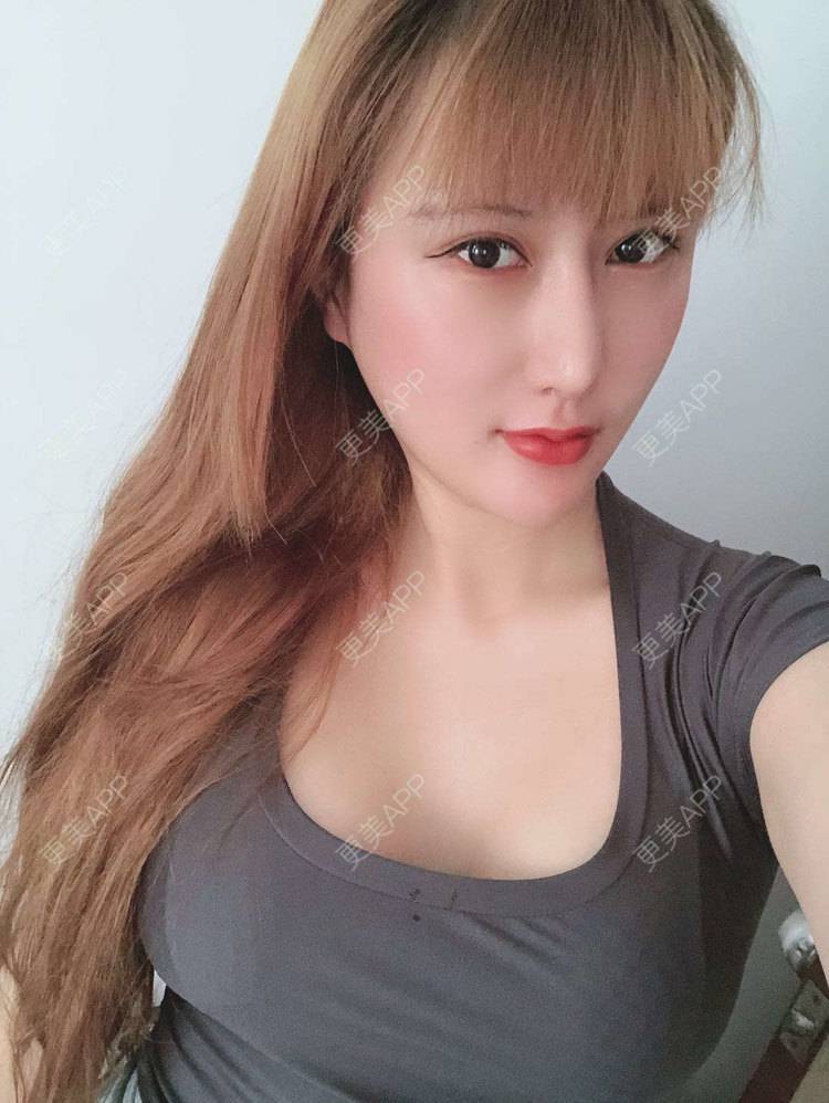 更美 - 再也不想吃泡面了的假体隆胸经验 | 广州 | 视频日记 | 假体隆胸