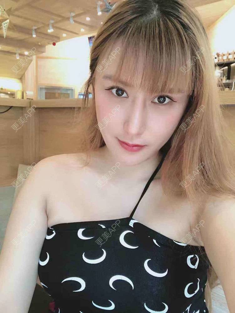 更美 - 再也不想吃泡面了的假体隆胸经验 | 广州 | 视频日记 | 假体隆胸