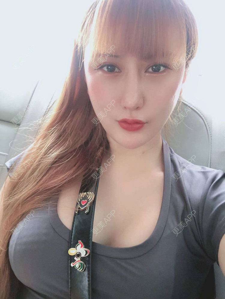 更美 - 再也不想吃泡面了的假体隆胸经验 | 广州 | 视频日记 | 假体隆胸