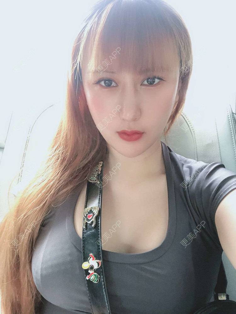 更美 - 再也不想吃泡面了的假体隆胸经验 | 广州 | 视频日记 | 假体隆胸