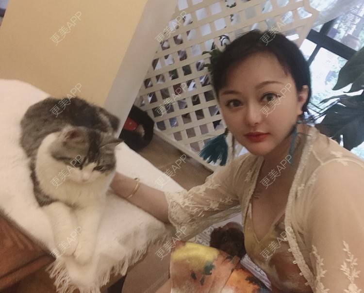 更美 - 三生有幸呀的硅胶垫下巴经验 | 硅胶垫下巴 | 膨体垫下巴 | 宽下巴矫正 | 下巴硅胶假体取出 | 下巴膨体假体取出