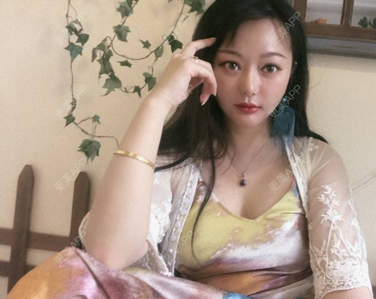 更美 - 三生有幸呀的硅胶垫下巴经验 | 硅胶垫下巴 | 膨体垫下巴 | 宽下巴矫正 | 下巴硅胶假体取出 | 下巴膨体假体取出