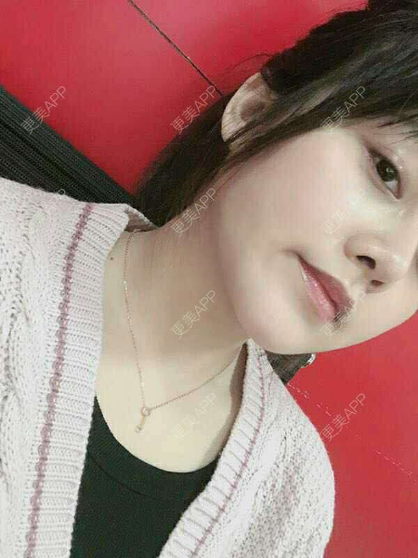 更美 - 小泥泥的吸脂瘦脸经验 | 吸脂瘦脸 | 双下巴吸脂 | 深圳