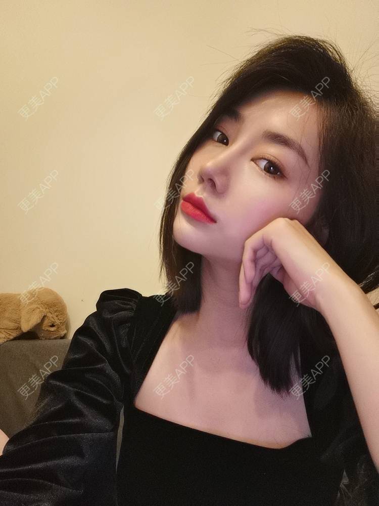 鼻综合,鼻综合多少钱_萌商女孩鼻综合多少钱_术后91天__更美整形