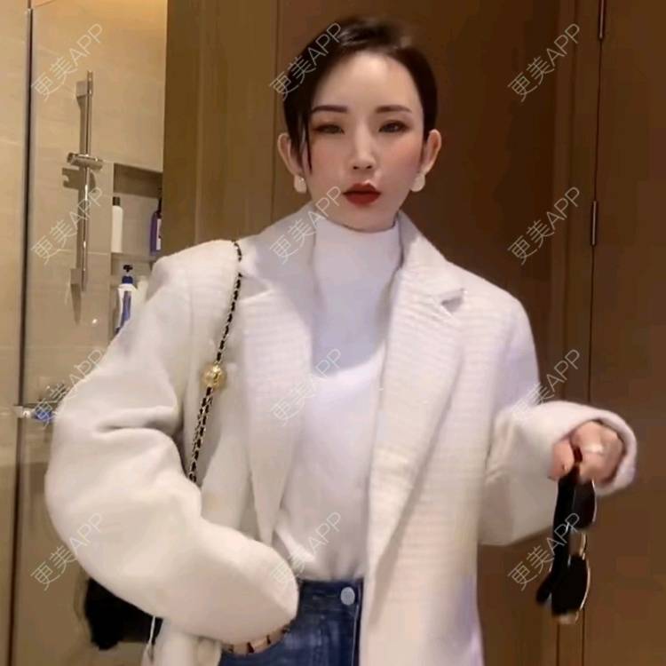 更美 - 更美用户2jgibyXw5G的玻尿酸下巴经验 | 哈尔滨 | 玻尿酸面颊