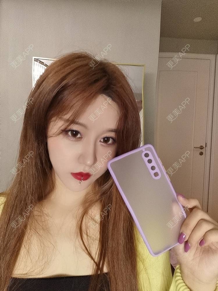 更美 - 素、颜╮浪的自体脂肪全面部填充经验 | 自体脂肪全面部填充 | 南京