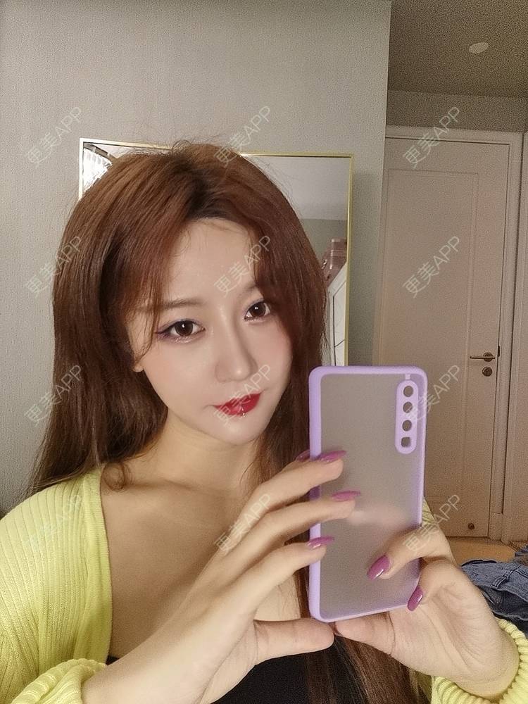 更美 - 素、颜╮浪的自体脂肪全面部填充经验 | 自体脂肪全面部填充 | 南京