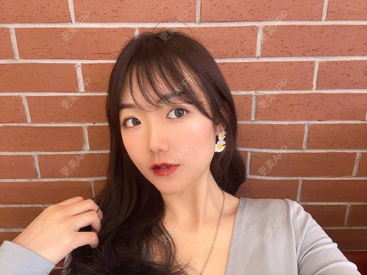 更美 - 镜子里你哭了.展的全切双眼皮经验 | 全切双眼皮 | 成都 | 眶隔脂肪释放 | 眼部多项