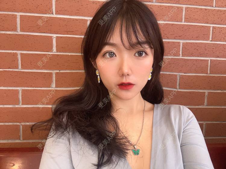 更美 - 镜子里你哭了.展的全切双眼皮经验 | 全切双眼皮 | 成都 | 眶隔脂肪释放 | 眼部多项