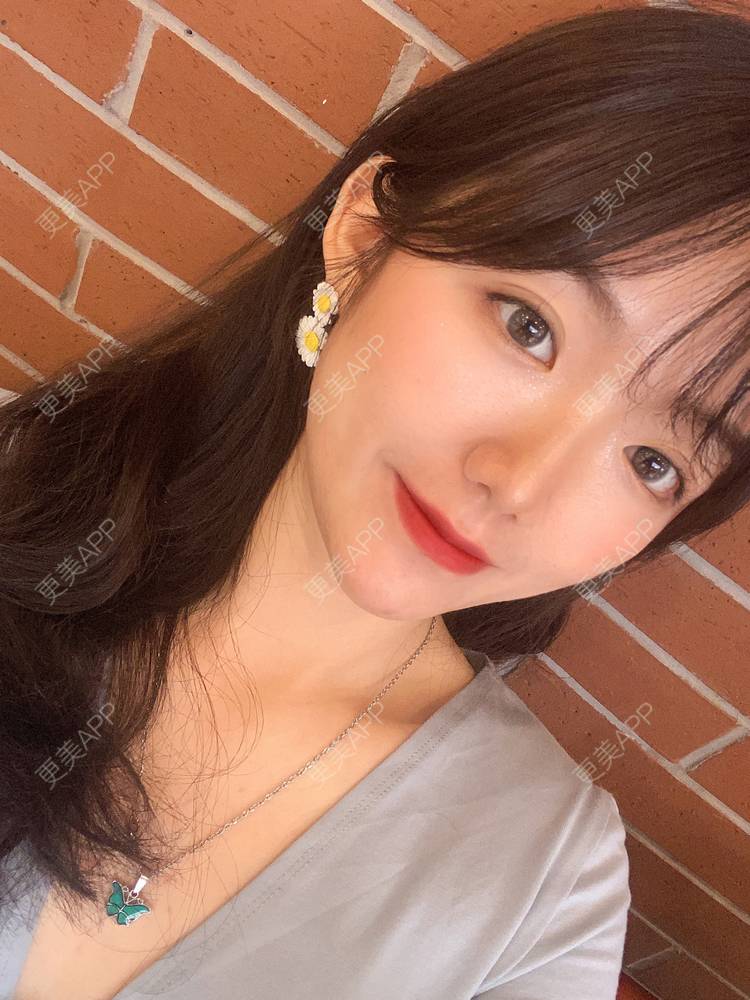 更美 - 镜子里你哭了.展的全切双眼皮经验 | 全切双眼皮 | 成都 | 眶隔脂肪释放 | 眼部多项