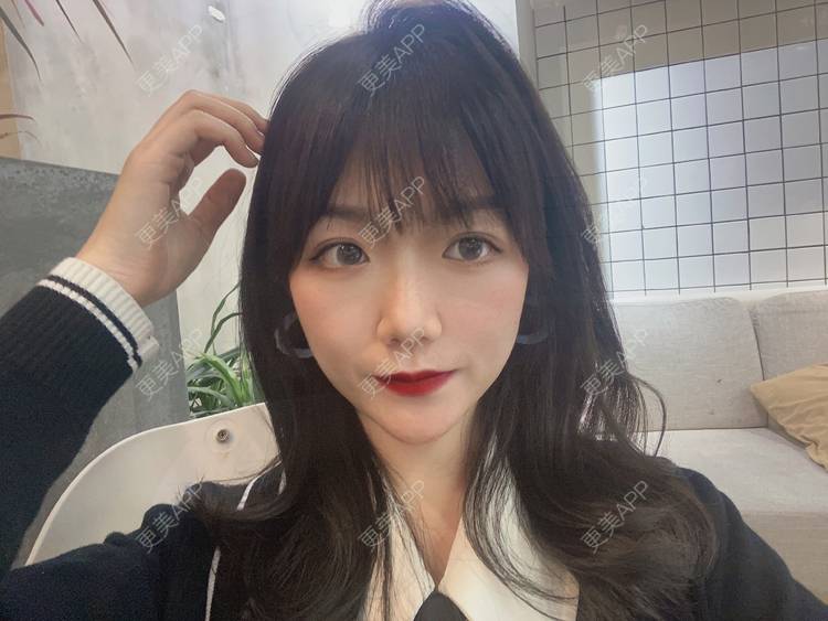 更美 - 镜子里你哭了.展的全切双眼皮经验 | 全切双眼皮 | 成都 | 眶隔脂肪释放 | 眼部多项