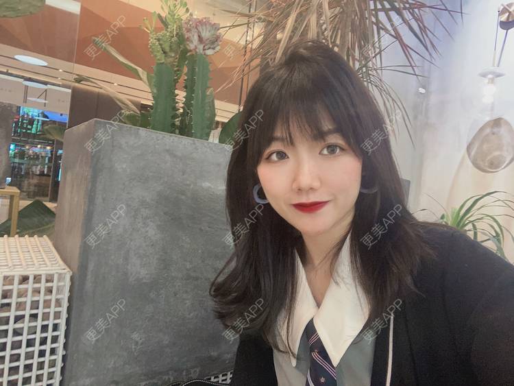 更美 - 镜子里你哭了.展的全切双眼皮经验 | 全切双眼皮 | 成都 | 眶隔脂肪释放 | 眼部多项