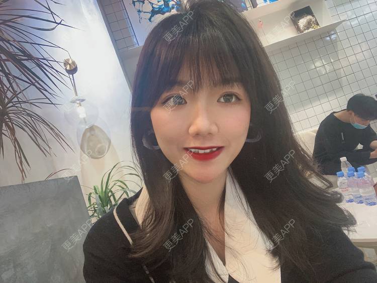 更美 - 镜子里你哭了.展的全切双眼皮经验 | 全切双眼皮 | 成都 | 眶隔脂肪释放 | 眼部多项