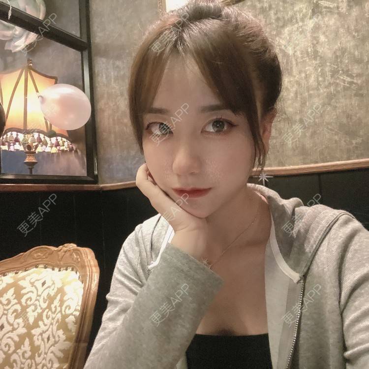更美 - 原地不动的自体脂肪隆鼻经验 | 自体脂肪隆鼻