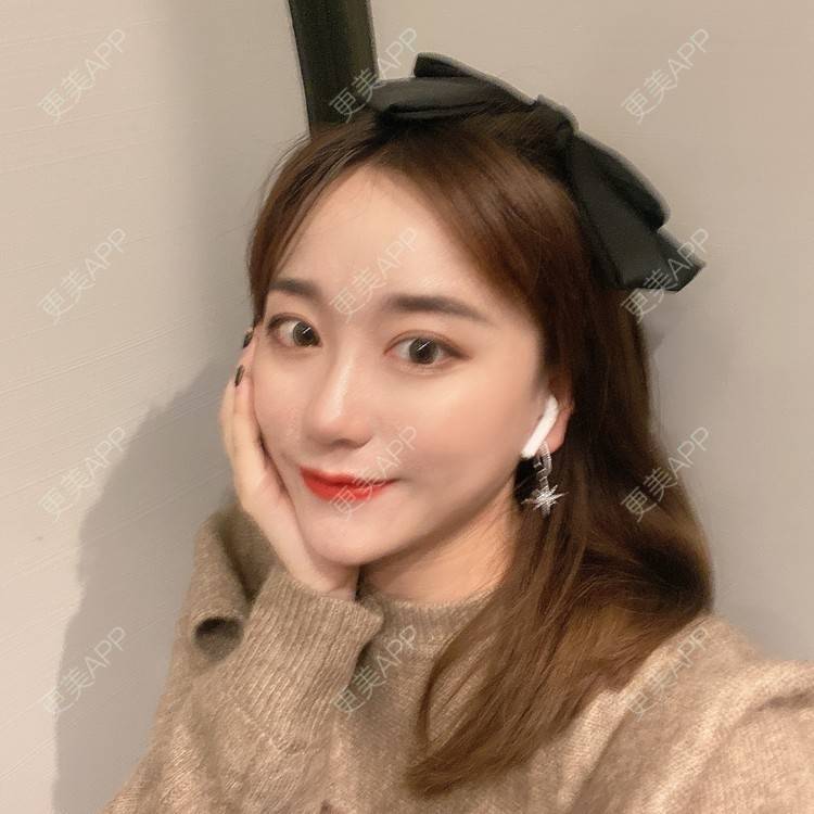 更美 - 原地不动的自体脂肪隆鼻经验 | 自体脂肪隆鼻