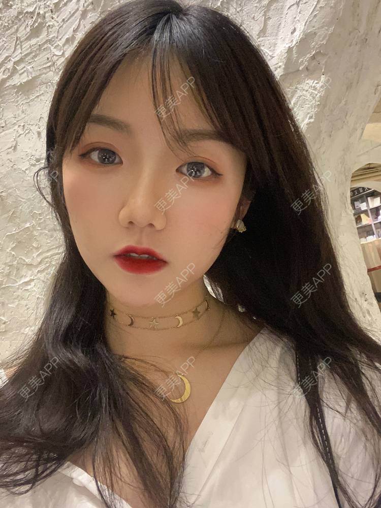 更美 - 镜子里你哭了.展的全切双眼皮经验 | 全切双眼皮 | 成都 | 眶隔脂肪释放 | 眼部多项