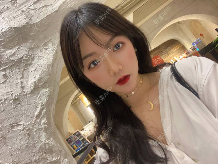 更美 - 镜子里你哭了.展的全切双眼皮经验 | 全切双眼皮 | 成都 | 眶隔脂肪释放 | 眼部多项