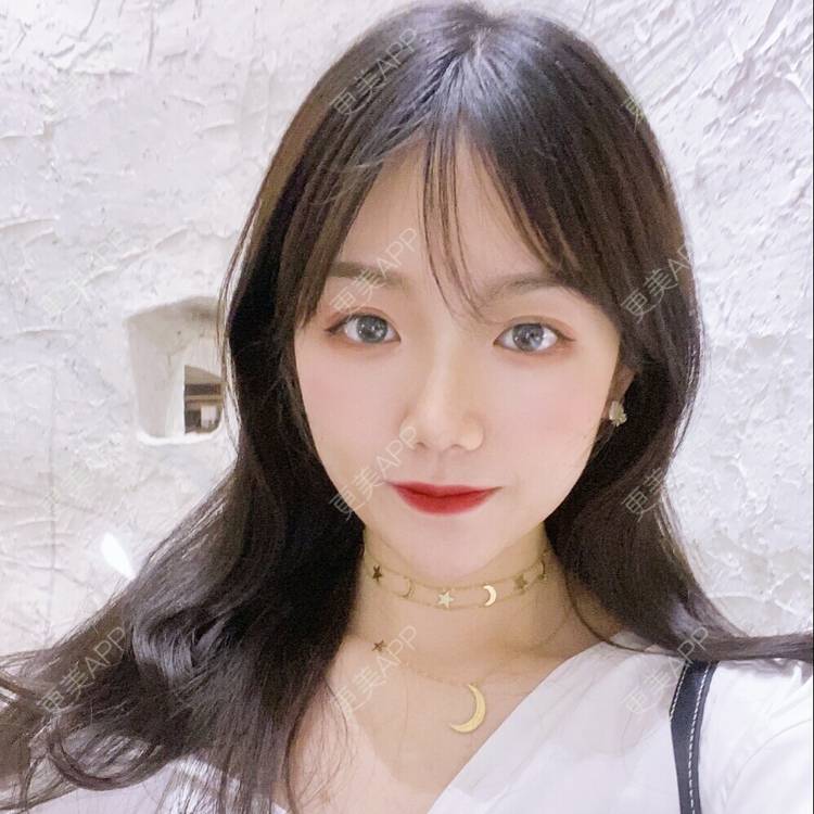 更美 - 镜子里你哭了.展的全切双眼皮经验 | 全切双眼皮 | 成都 | 眶隔脂肪释放 | 眼部多项