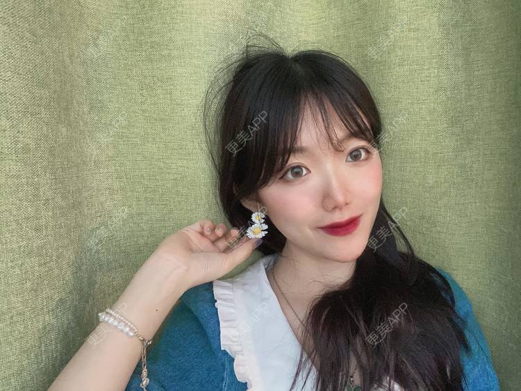 更美 - 镜子里你哭了.展的全切双眼皮经验 | 全切双眼皮 | 成都 | 眶隔脂肪释放 | 眼部多项