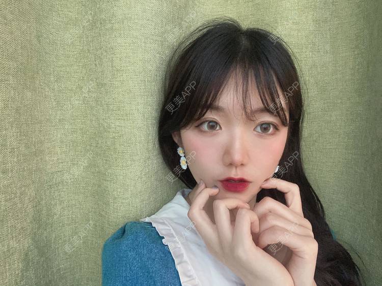 更美 - 镜子里你哭了.展的全切双眼皮经验 | 全切双眼皮 | 成都 | 眶隔脂肪释放 | 眼部多项