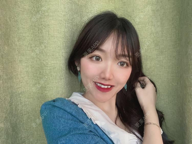 更美 - 镜子里你哭了.展的全切双眼皮经验 | 全切双眼皮 | 成都 | 眶隔脂肪释放 | 眼部多项