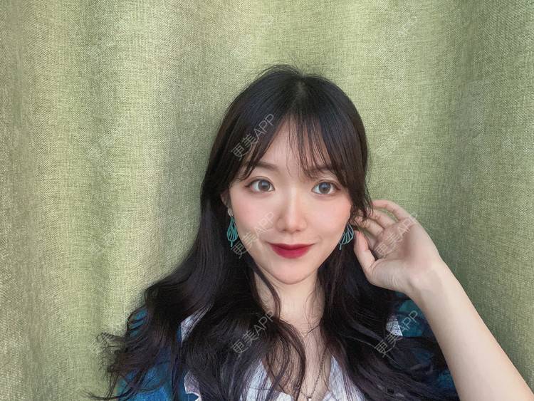 更美 - 镜子里你哭了.展的全切双眼皮经验 | 全切双眼皮 | 成都 | 眶隔脂肪释放 | 眼部多项