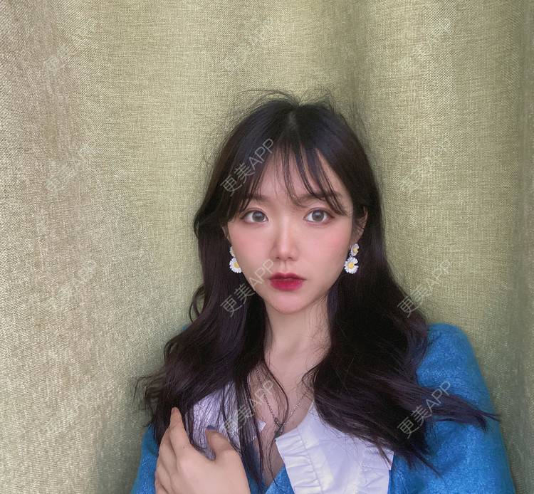 更美 - 镜子里你哭了.展的全切双眼皮经验 | 全切双眼皮 | 成都 | 眶隔脂肪释放 | 眼部多项