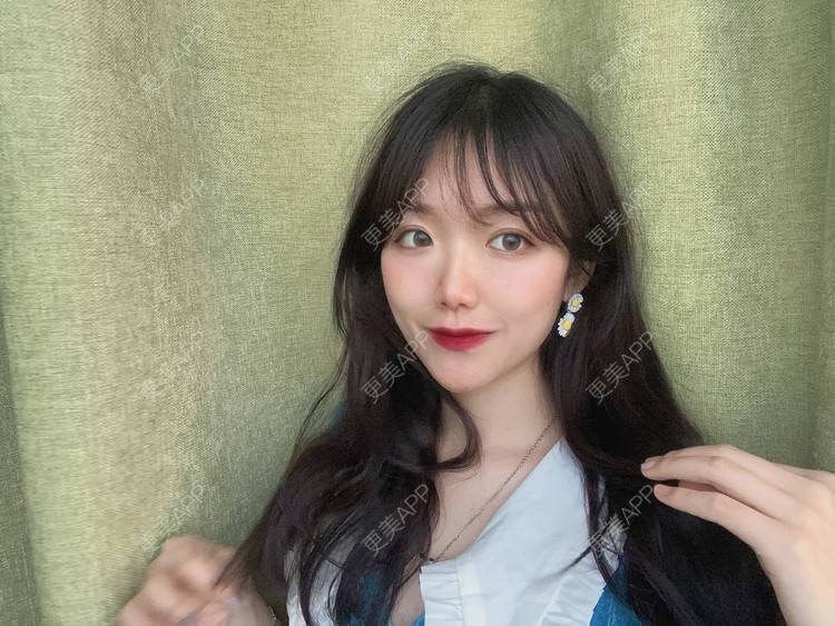 更美 - 镜子里你哭了.展的全切双眼皮经验 | 全切双眼皮 | 成都 | 眶隔脂肪释放 | 眼部多项