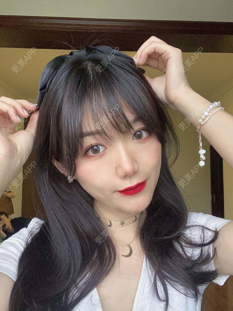 更美 - 镜子里你哭了.展的全切双眼皮经验 | 全切双眼皮 | 成都 | 眶隔脂肪释放 | 眼部多项