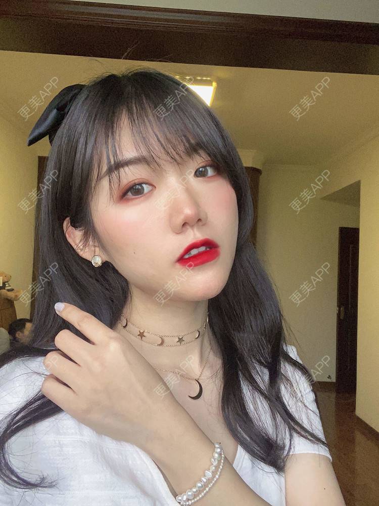 更美 - 镜子里你哭了.展的全切双眼皮经验 | 全切双眼皮 | 成都 | 眶隔脂肪释放 | 眼部多项