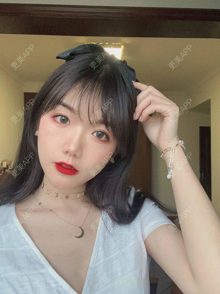 更美 - 镜子里你哭了.展的全切双眼皮经验 | 全切双眼皮 | 成都 | 眶隔脂肪释放 | 眼部多项