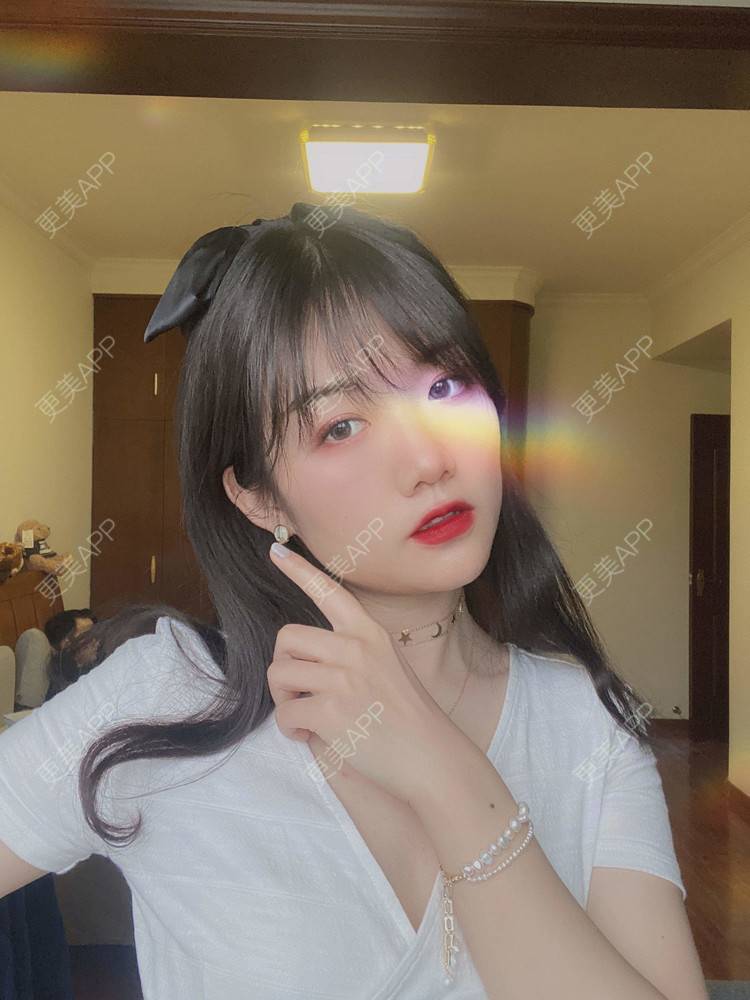 更美 - 镜子里你哭了.展的全切双眼皮经验 | 全切双眼皮 | 成都 | 眶隔脂肪释放 | 眼部多项