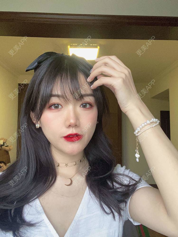 更美 - 镜子里你哭了.展的全切双眼皮经验 | 全切双眼皮 | 成都 | 眶隔脂肪释放 | 眼部多项