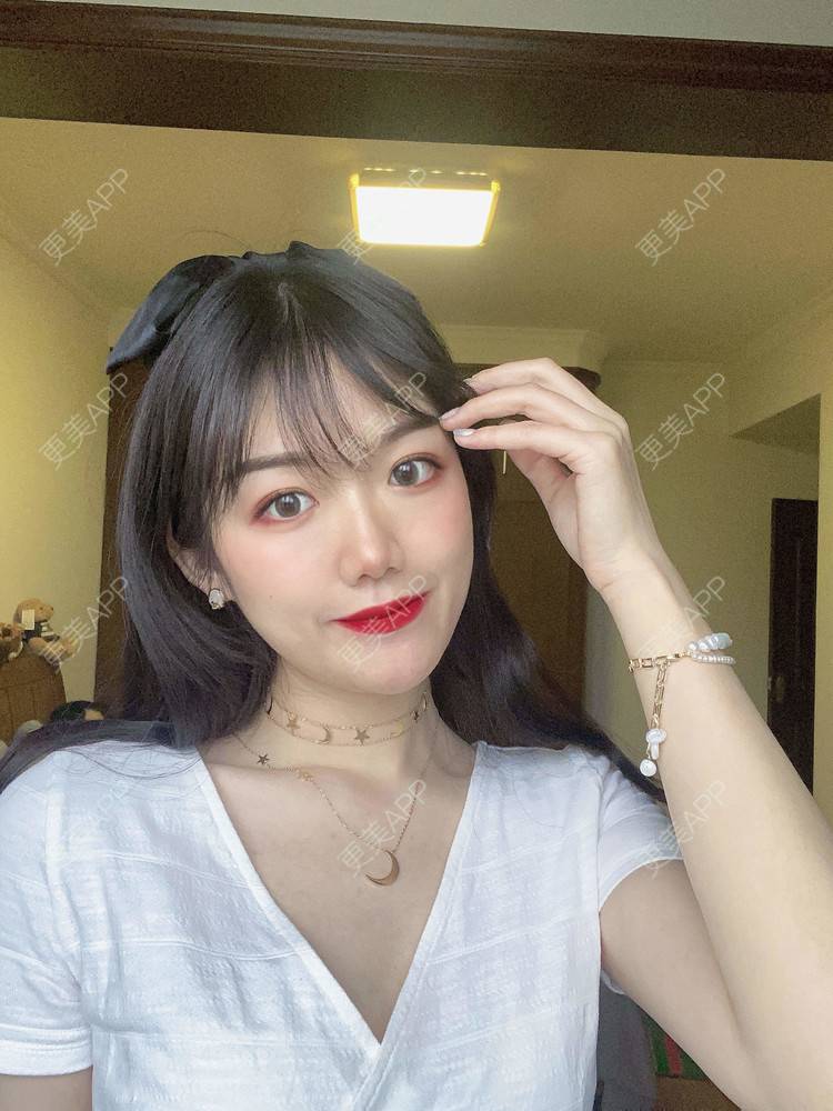 更美 - 镜子里你哭了.展的全切双眼皮经验 | 全切双眼皮 | 成都 | 眶隔脂肪释放 | 眼部多项