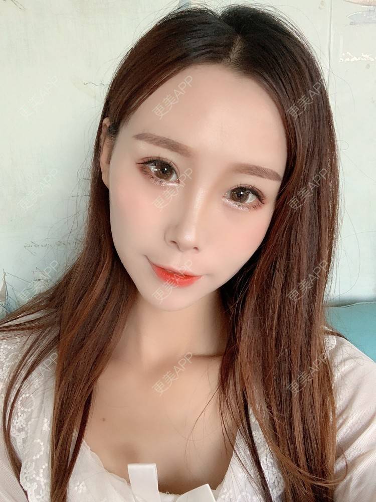 更美 - 更美用户HFUxfsPniM的眼部多项经验 | 眼部多项 | 南京