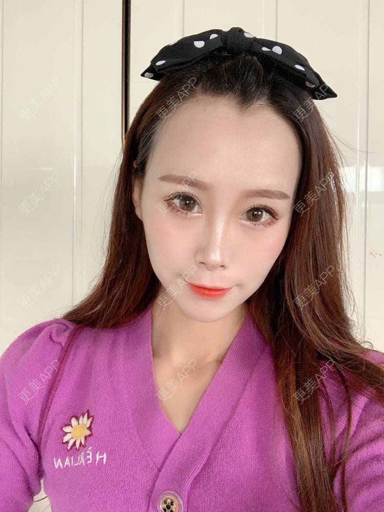 更美 - 更美用户HFUxfsPniM的眼部多项经验 | 眼部多项 | 南京