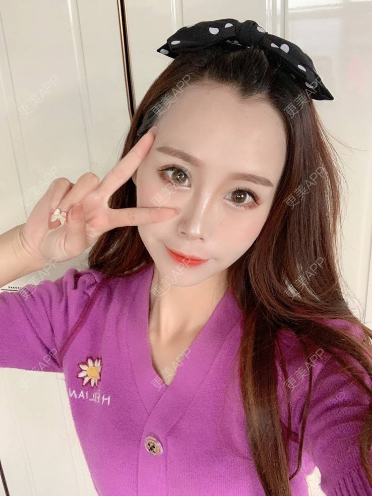 更美 - 更美用户HFUxfsPniM的眼部多项经验 | 眼部多项 | 南京