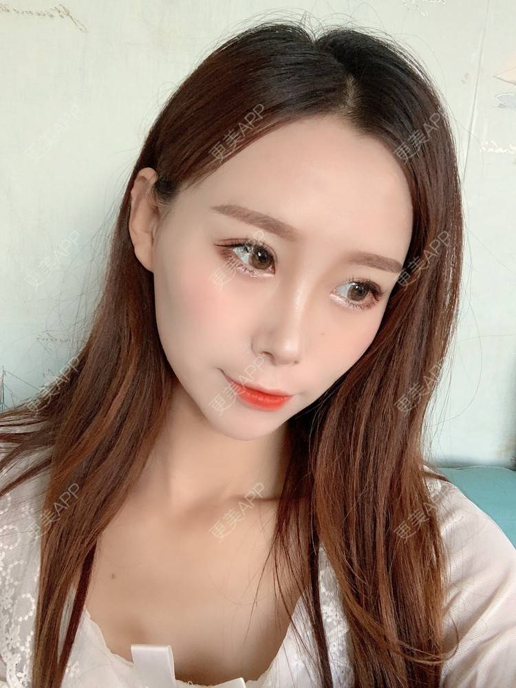 更美 - 更美用户HFUxfsPniM的眼部多项经验 | 眼部多项 | 南京