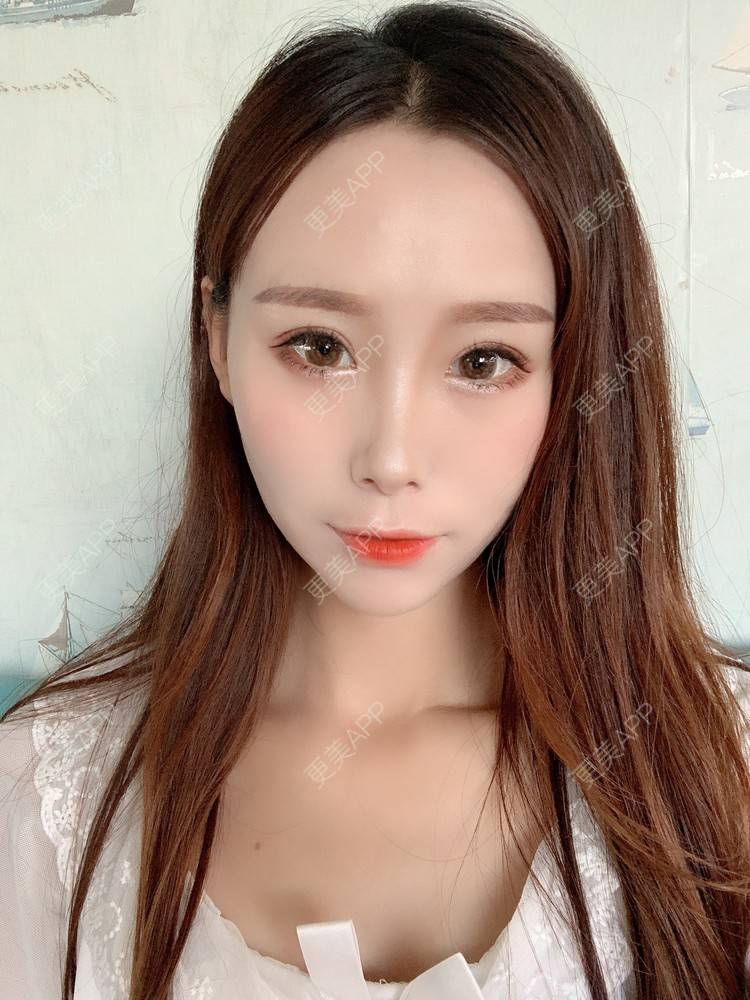 更美 - 更美用户HFUxfsPniM的眼部多项经验 | 眼部多项 | 南京