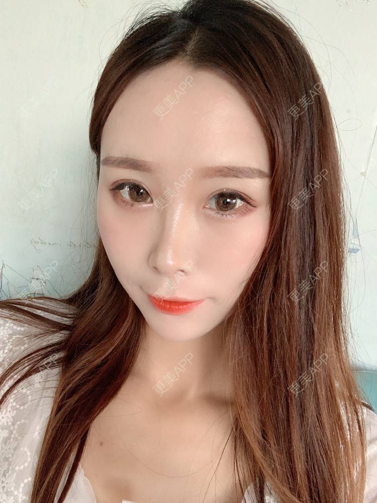 更美 - 更美用户HFUxfsPniM的眼部多项经验 | 眼部多项 | 南京