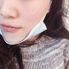 更美 - ︴猫猫怪￣ˇ￣苹的硅胶垫下巴经验 | 硅胶垫下巴 | 广州