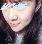 更美 - ︴猫猫怪￣ˇ￣苹的硅胶垫下巴经验 | 硅胶垫下巴 | 广州