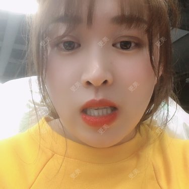 更美用户nOSa2OXrxm