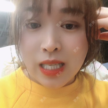 更美用户nOSa2OXrxm