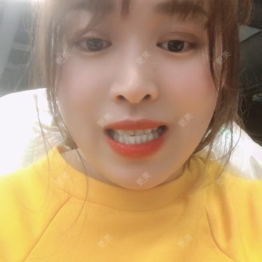 更美用户nOSa2OXrxm