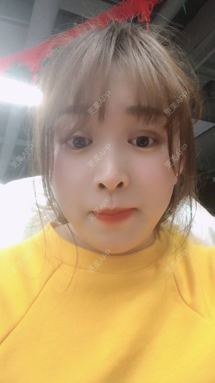 更美 - 更美用户nOSa2OXrxm的冷光美白经验 | 北京 | 冷光美白