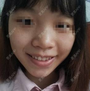 更美 - #＋弥撒少女位的黄金微针经验 | 黄金微针 | 广州